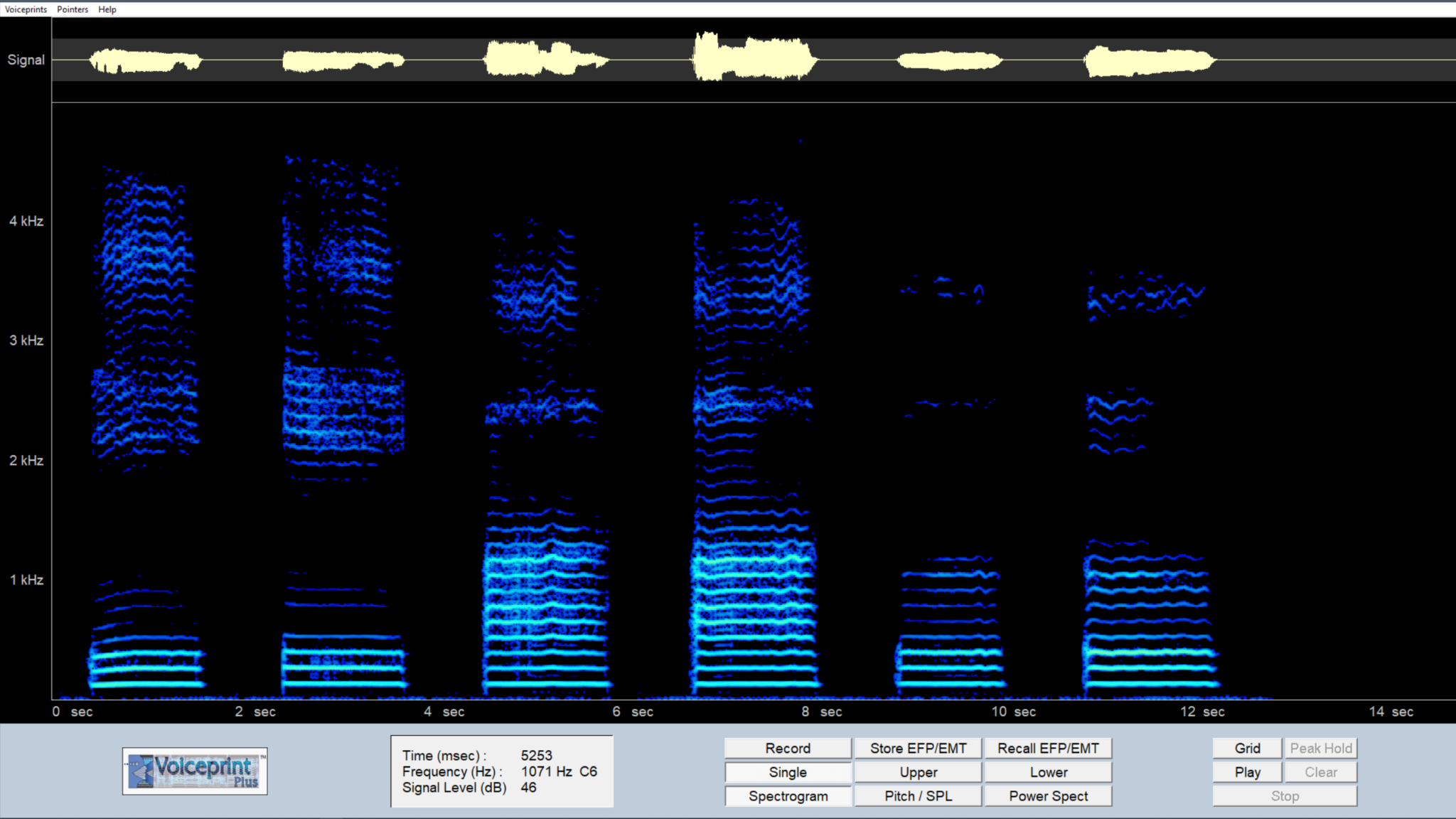 What is Estill? a method or technique or...?